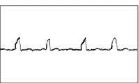 Zjh6b.gif (1396 字節(jié))