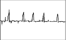 Zjh6a.GIF (2299 字節(jié))