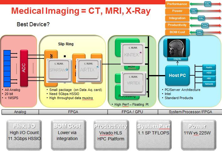 Xilinx 7系列FPGA在醫療成像方面的應用