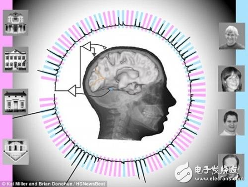 腦電波技術(shù)再上一層樓，讀心準確率高達95%